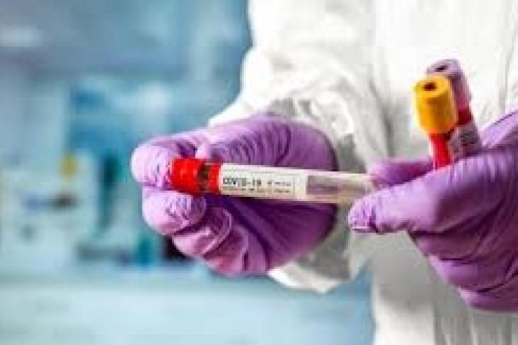 Офіційна інформація про кількість захворілих на COVID-19 в Україні та в Одеській області за минулу добу